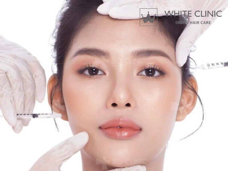 tiêm botox xoá nhăn trán