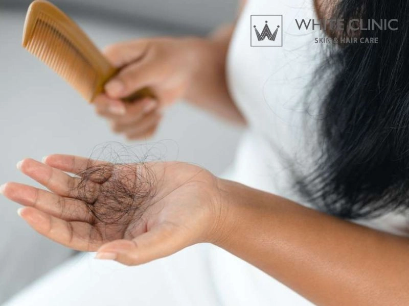 tóc đột nhiên rụng nhiều tóc đột nhiên rụng nhiều