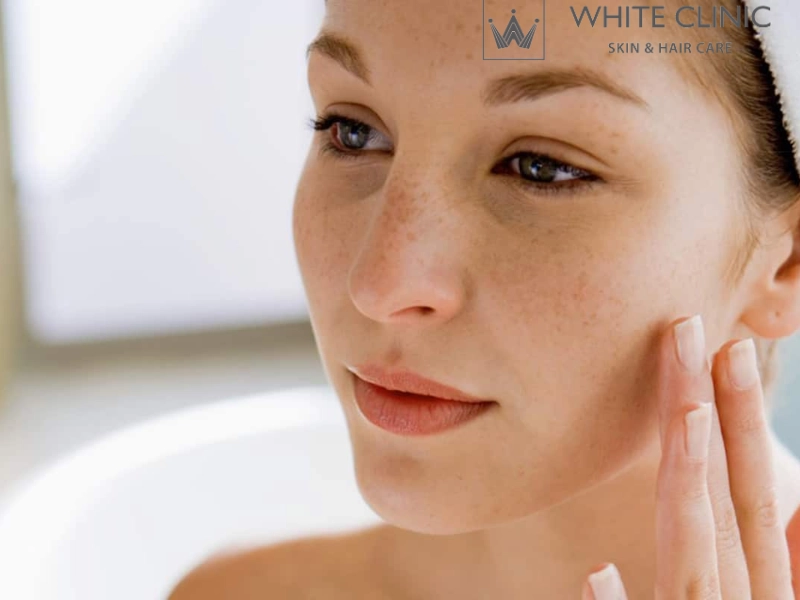 laser trị nám laser trị nám