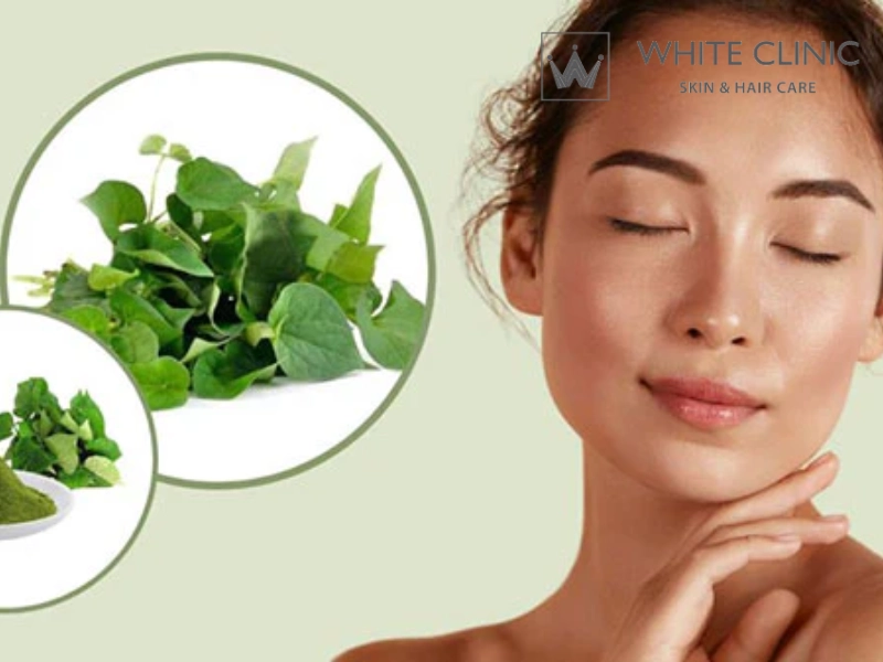 trị mụn bằng rau diếp cá