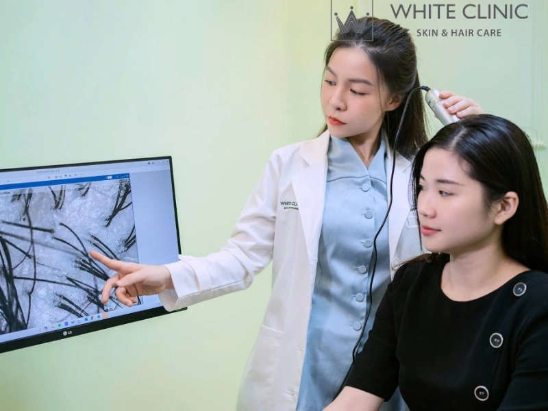 cách chữa hói đỉnh đầu