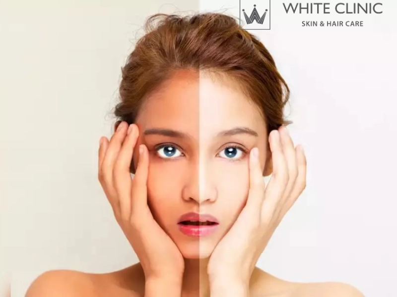 da bị cháy nắng có phục hồi được không