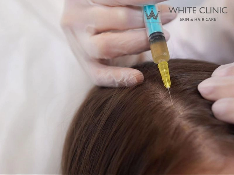 Liệu pháp thẩm mỹ y khoa tiêm PRP (Huyết tương giàu tiểu cầu) Liệu pháp thẩm mỹ y khoa tiêm PRP (Huyết tương giàu tiểu cầu)