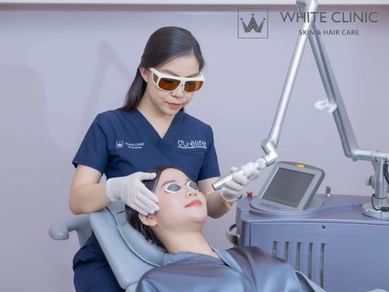 laser co2 trị mụn