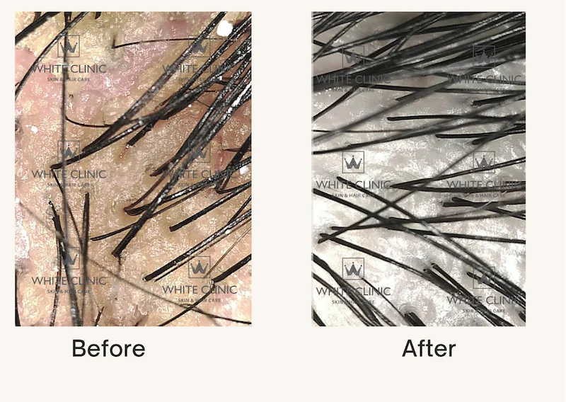 Chọn White Clinic cho da đầu khỏe mạnh 