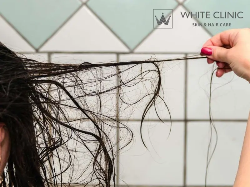 gội đầu bị rụng tóc nhiều gội đầu bị rụng tóc nhiều