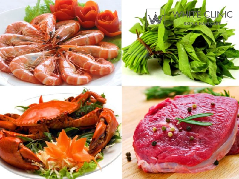 kiêng ăn gì sau khi bắn laser co2