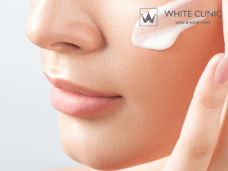 Điều Trị Vết Thâm Đen Sau Mụn Bằng Công Nghệ Laser Hiện Đại An Toàn 