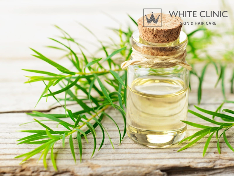 trị mụn bằng tinh dầu tràm