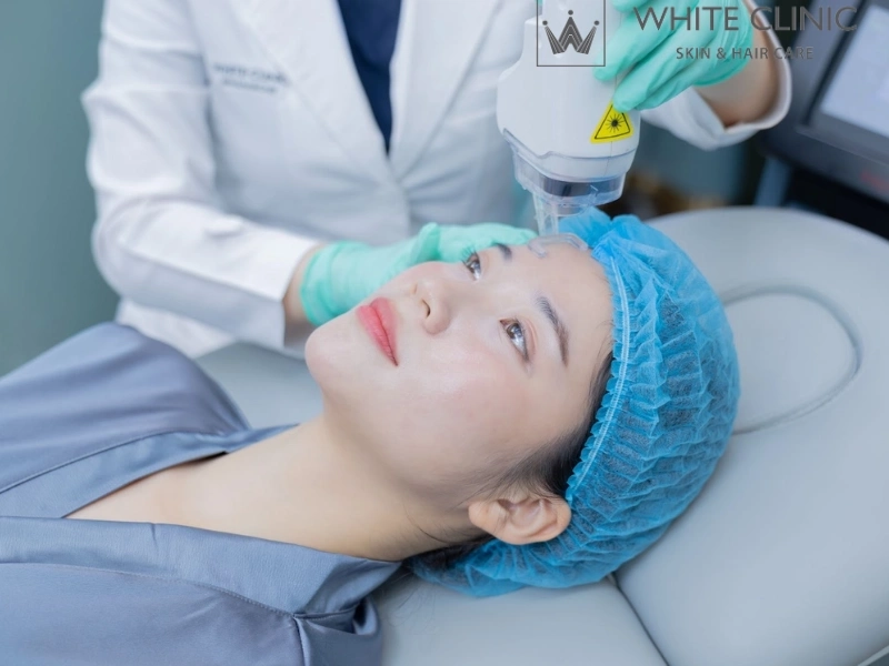 Chọn White Clinic để trải nghiệm Laser CO2 Fractional êm ái Chọn White Clinic để trải nghiệm Laser CO2 Fractional êm ái