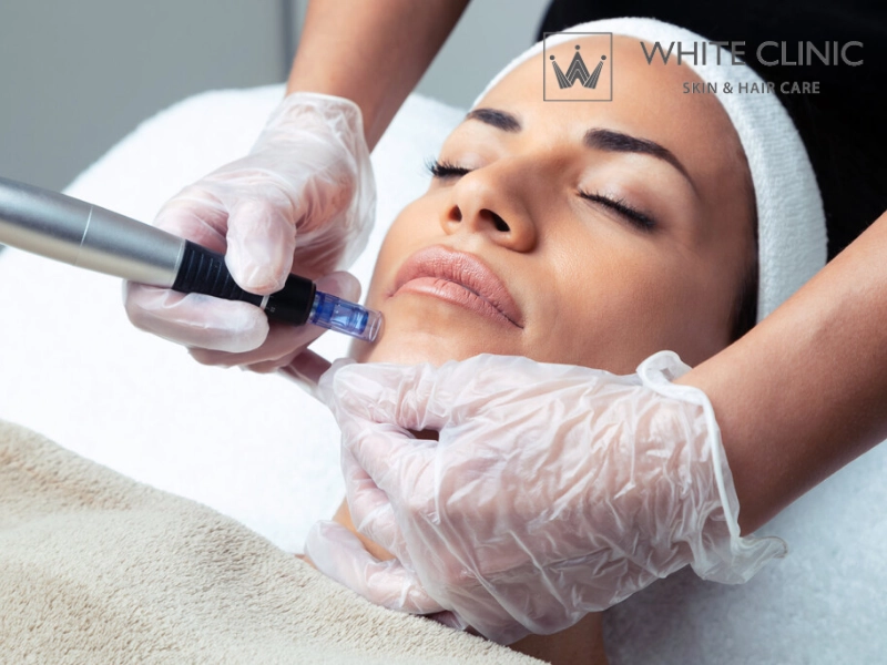 laser fractional co2 giá