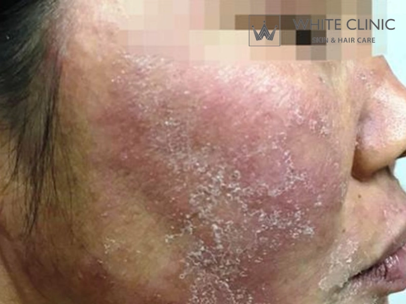 tác hại kem trộn tác hại kem trộn