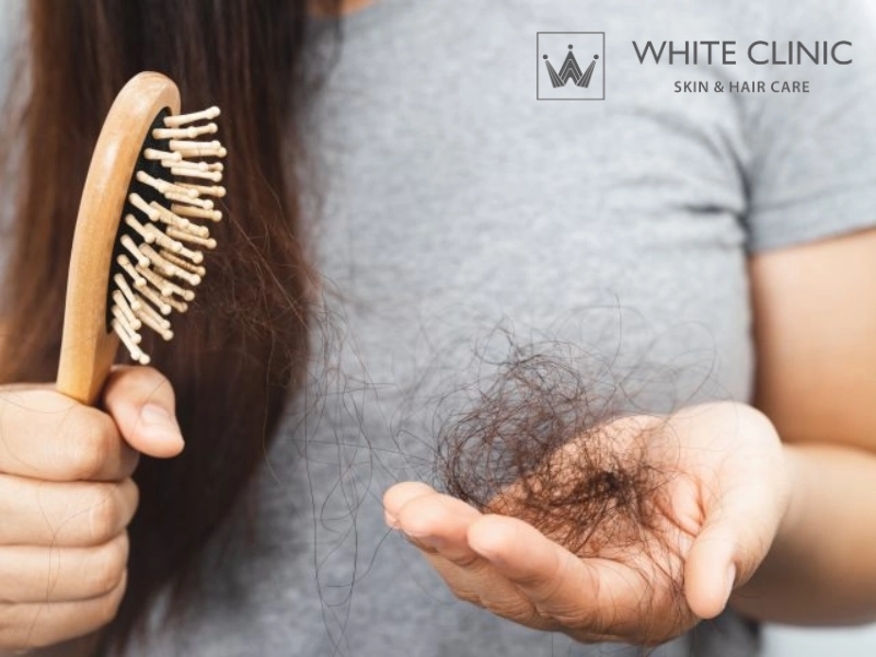 rụng tóc do tuyến giáp rụng tóc do tuyến giáp