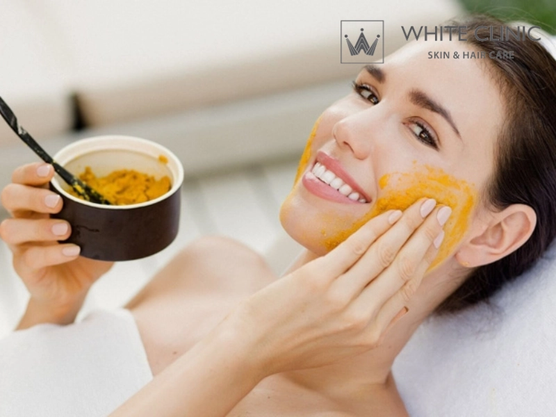 bôi nghệ tươi có trị mụn không