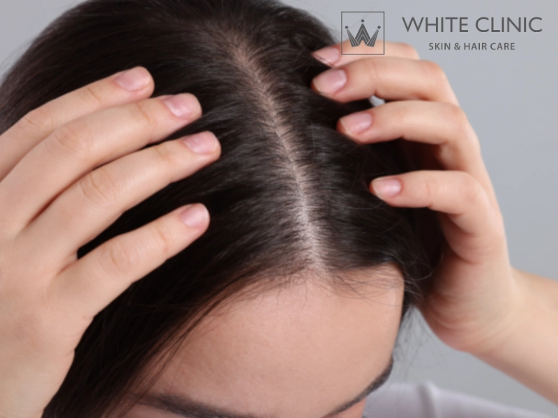 Phục hồi sức khỏe da đầu