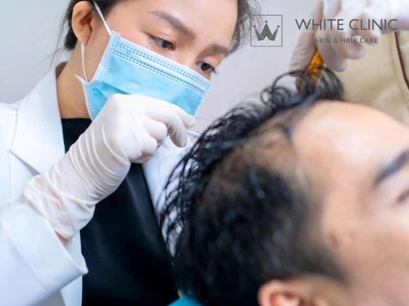 mất cân bằng nội tiết gây rụng tóc