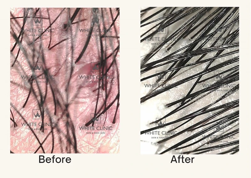 gội đầu trị liệu gội đầu trị liệu