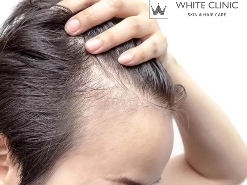 nuôi dưỡng nang tóc