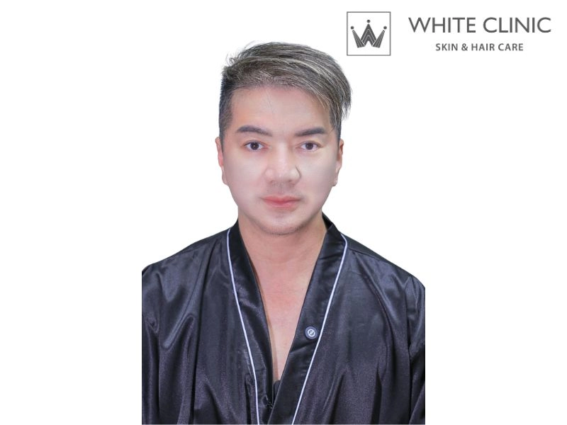 nâng cơ trẻ hóa