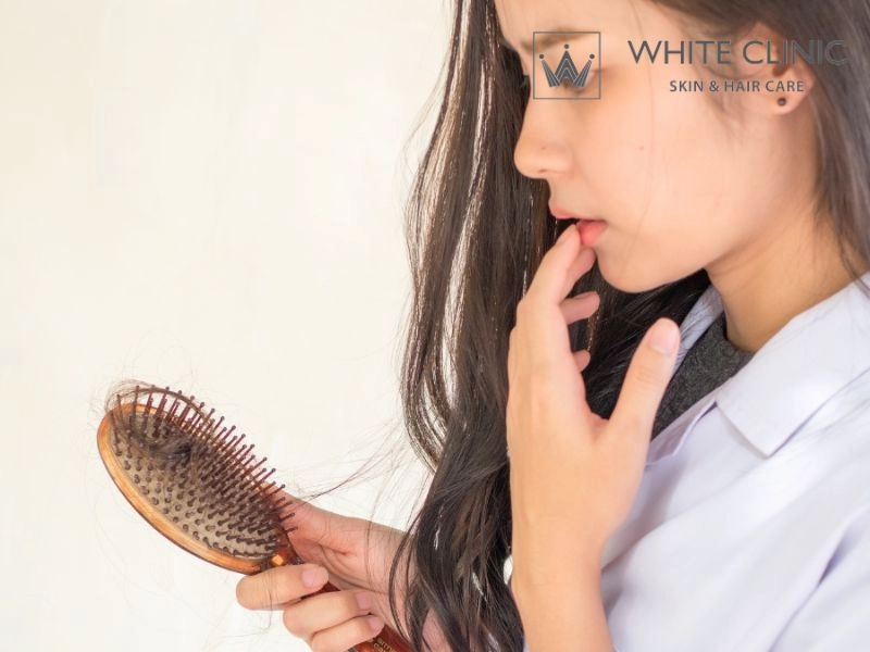 rụng tóc nhiều ở nữ tuổi 17 có sao không