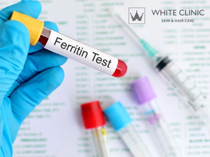 thiếu sắt có rụng tóc không