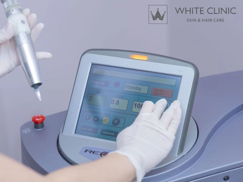 Tại sao chọn White Clinic để điều trị TONE UP LASER
