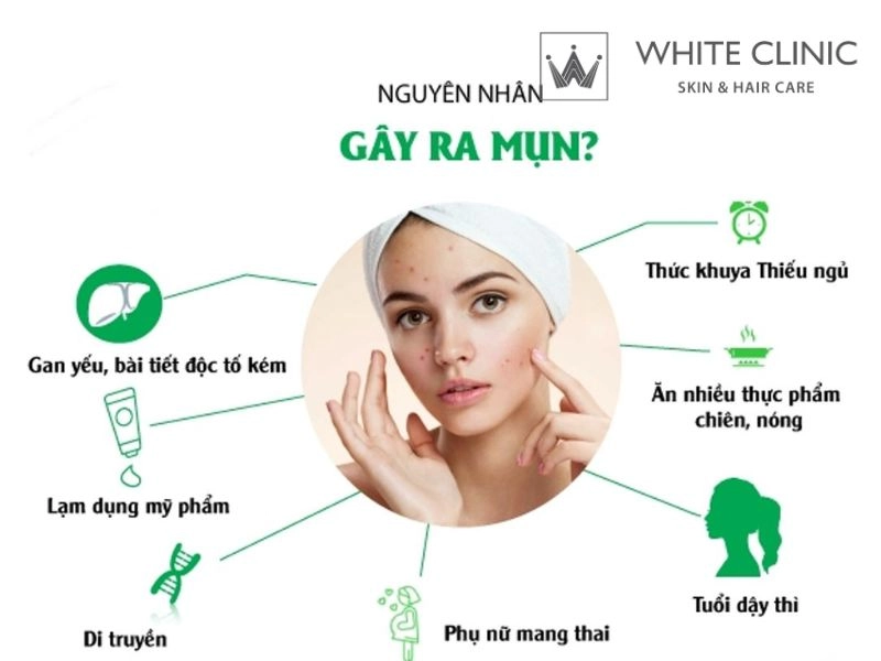cách giảm mụn