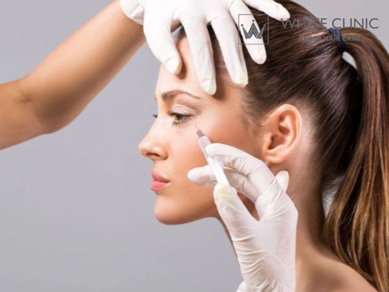 meso botox kiềm dầu