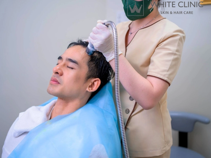 da đầu mỏng yếu da đầu mỏng yếu