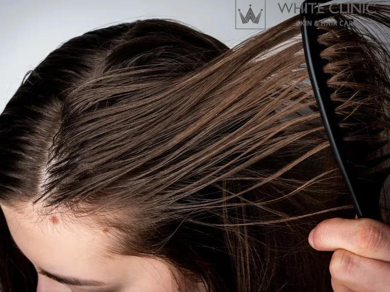 giảm tiết bã nhờn da đầu