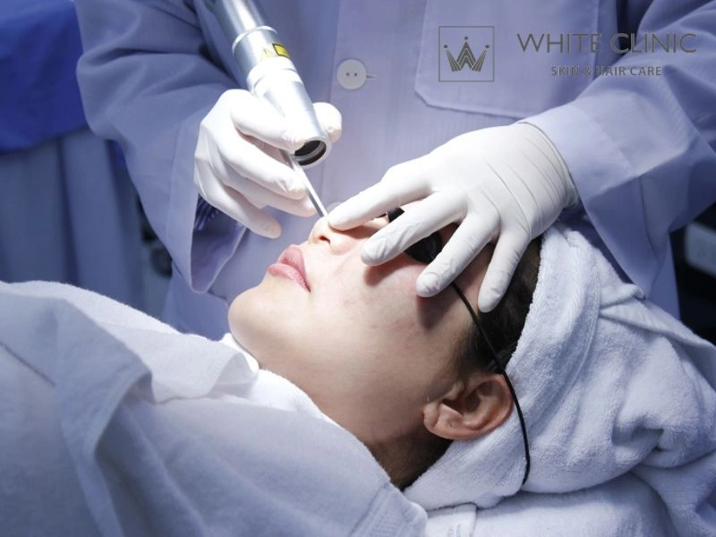 Ghép nối phương pháp điều trị theo từng loại sẹo: Không có "công thức chung"