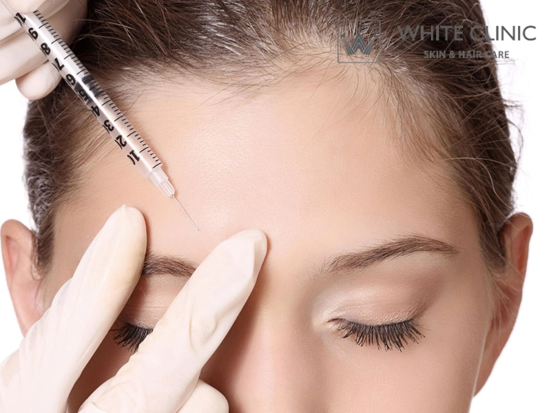 Tiêm Botox Xóa Nhăn Trán: Phân Biệt Loại Nhăn Để Điều Trị Hiệu Quả Và An Toàn