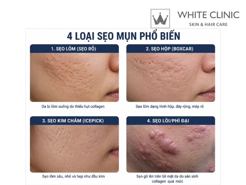 trị sẹo thâm
