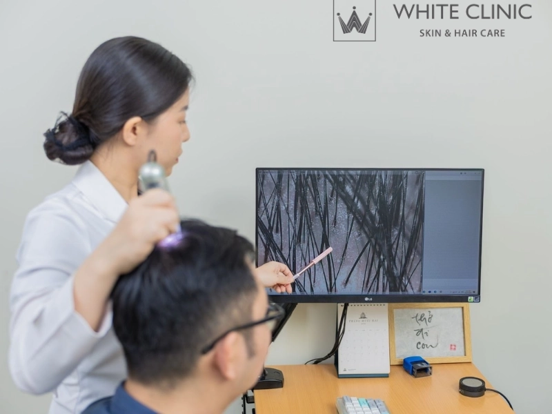 White Clinic là địa chỉ tin cậy trong điều trị da đầu nhờn rụng tóc White Clinic là địa chỉ tin cậy trong điều trị da đầu nhờn rụng tóc