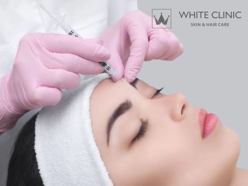 Tiêm Botox duy trì được bao lâu và thời điểm vàng để tiêm nhắc lại