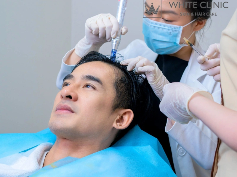 da đầu yếu da đầu yếu