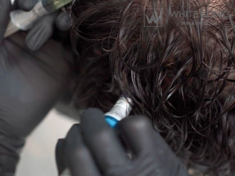 HAIR BOOSTER HAIR BOOSTER