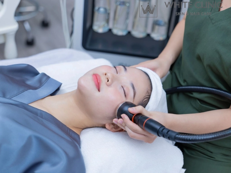 phục hồi da mặt bị cháy nắng