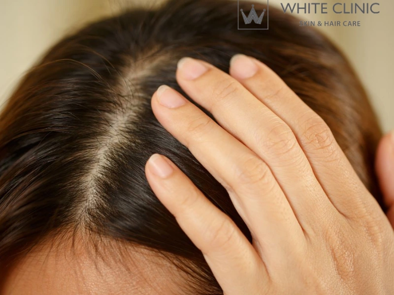 nuôi dưỡng nang tóc