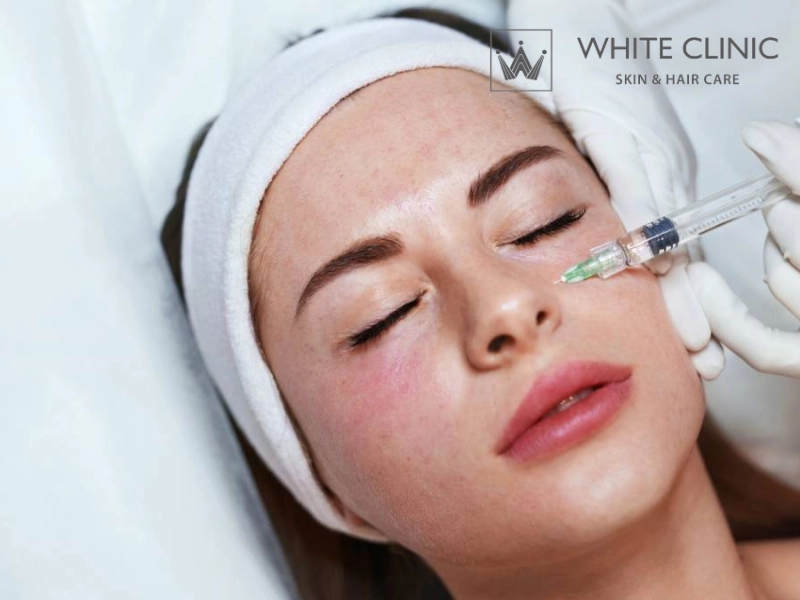 tiêm meso trị mụn