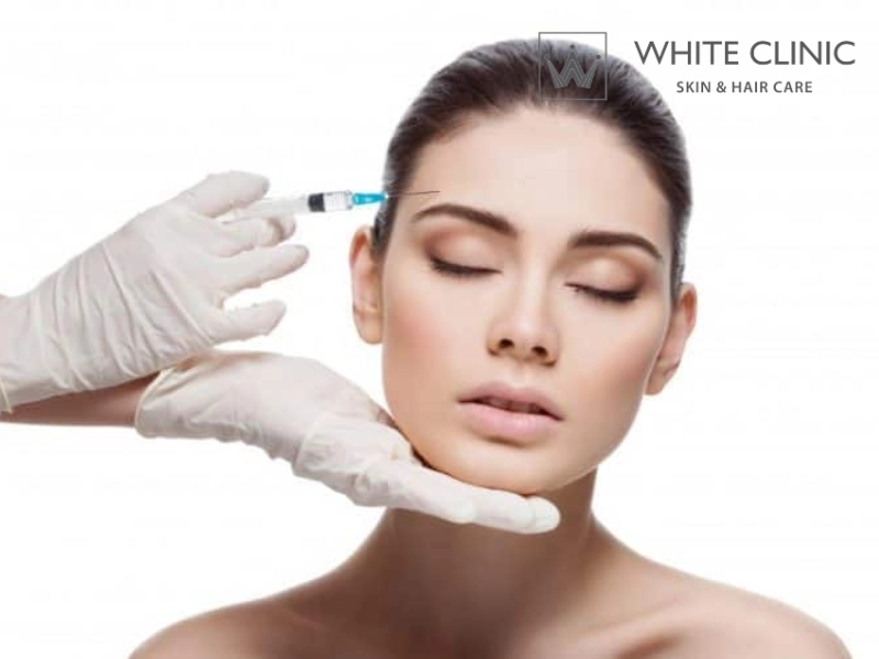 meso botox kiềm dầu