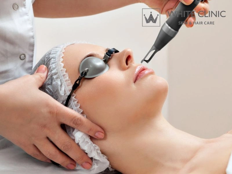 Cách trị mụn bằng liệu pháp y khoa