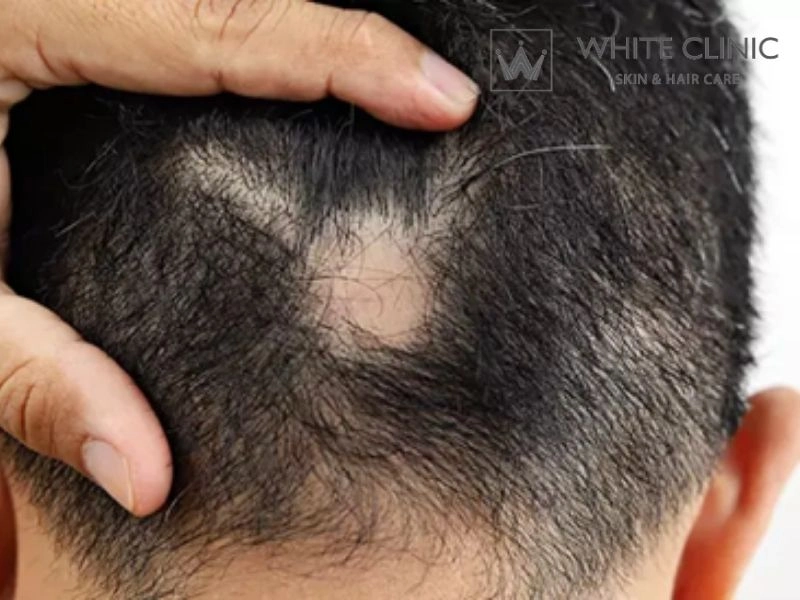 Những "hố đen" trong quá trình điều trị cần lưu ý Những "hố đen" trong quá trình điều trị cần lưu ý