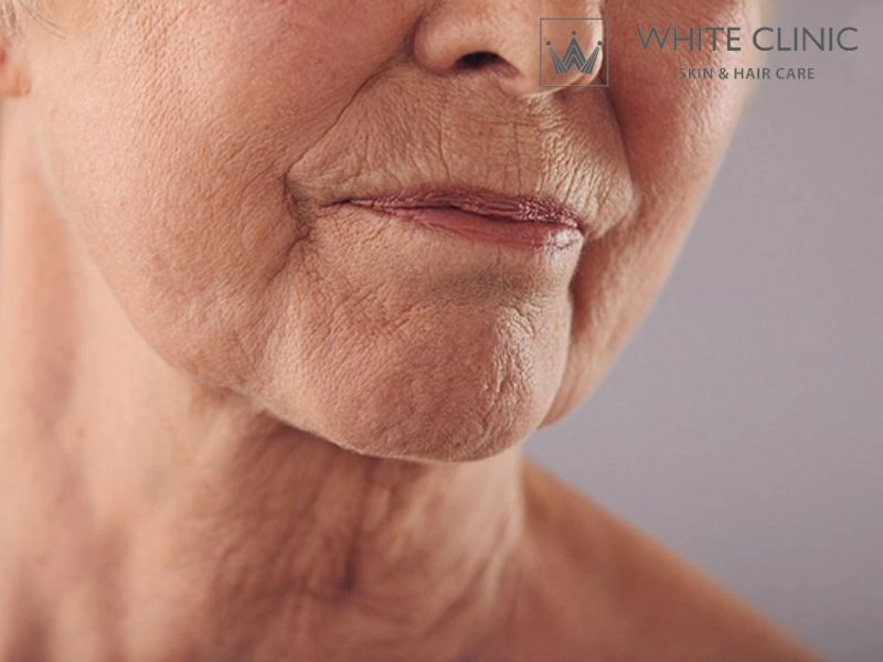 Bí Quyết Làm Săn Chắc Da Đánh Bay Lão Hóa Cùng White Clinic