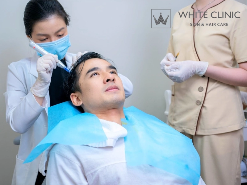 chữa rụng tóc nội tiết