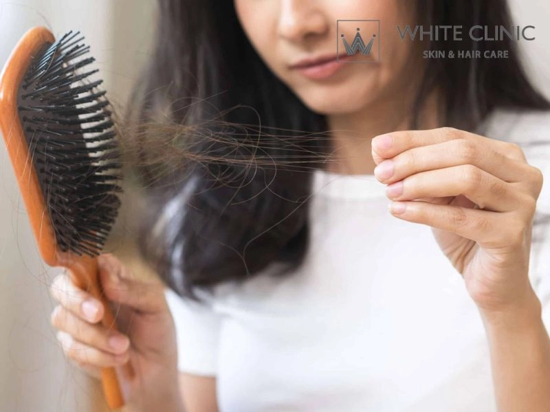 Nguyên Nhân Gây Rụng Tóc Ở Tuổi Dậy Thì Và Liệu Pháp Phục Hồi Tại White Clinic