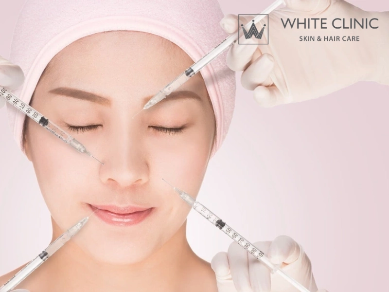 hướng dẫn kỹ thuật tiêm filler hướng dẫn kỹ thuật tiêm filler