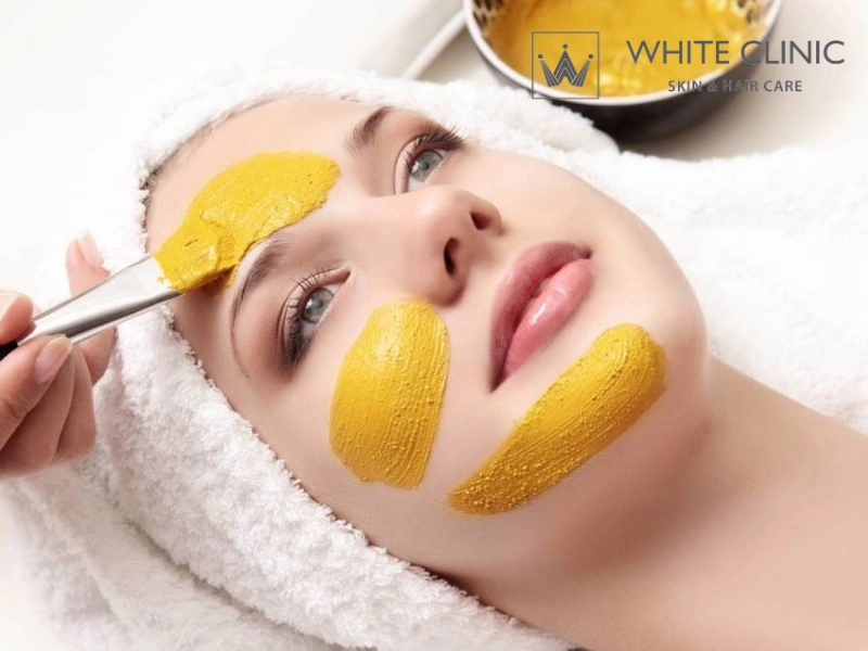 cách dùng tinh bột nghệ trị thâm mụn