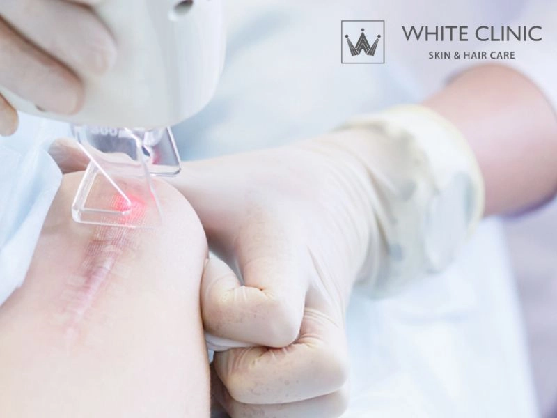Lộ trình điều trị thực tế và tiêu chí đánh giá đáp ứng tại White Clinic