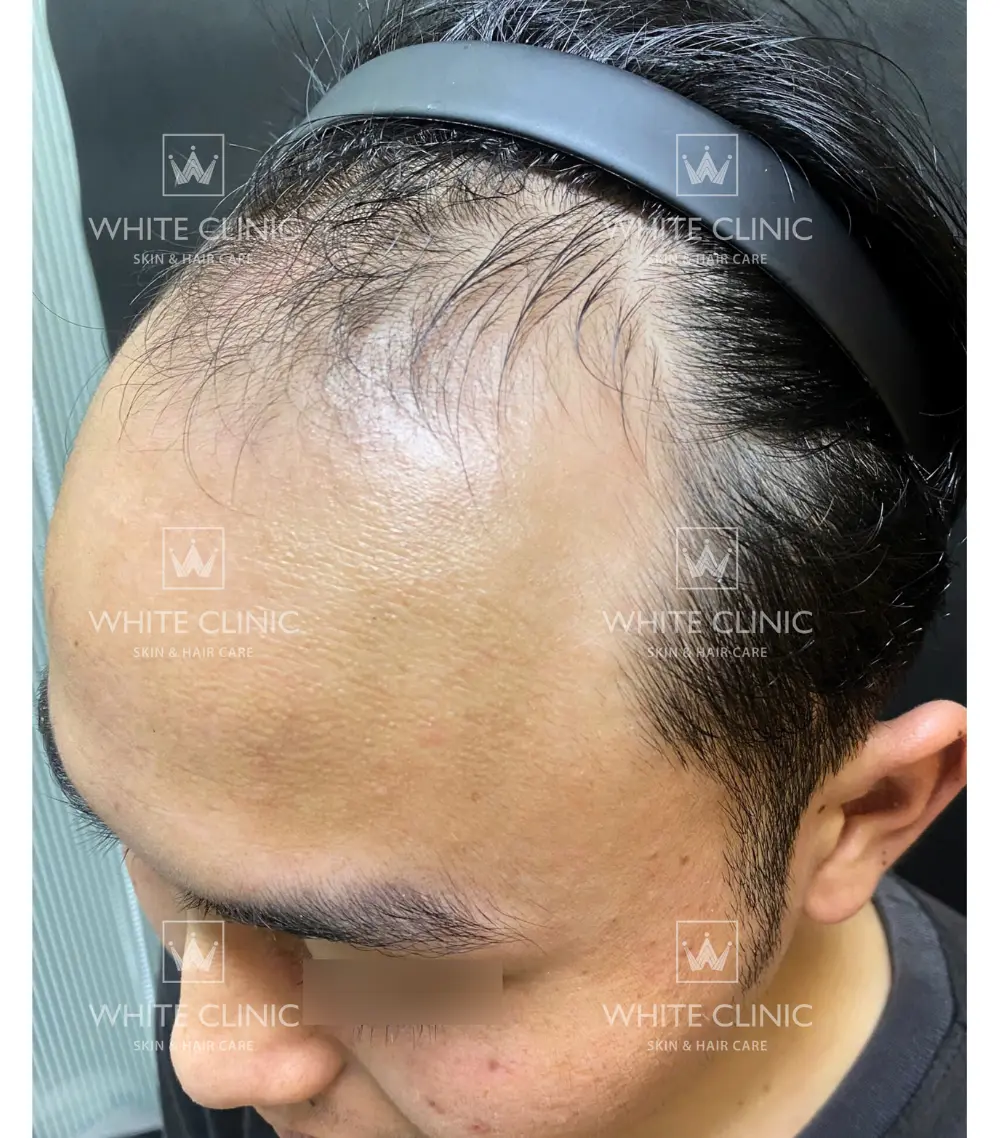 Bạn Nguyễn Hải Đ